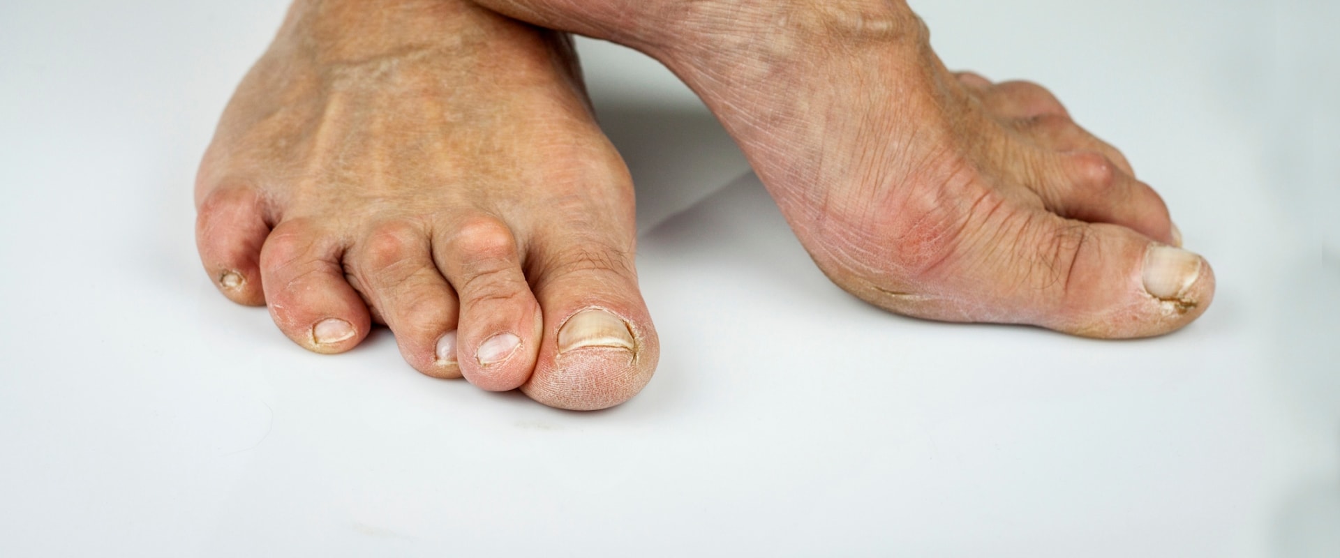 Expert Tips for Maintaining Healthy Feet as You Age