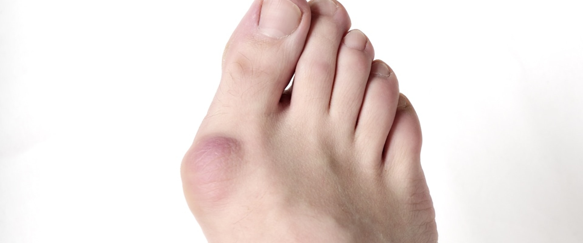 Expert Insights: Understanding and Treating Painful Foot Conditions