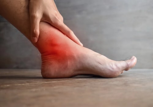 The Foot Doctor's Guide To Recognizing And Treating Charcot Foot Stages