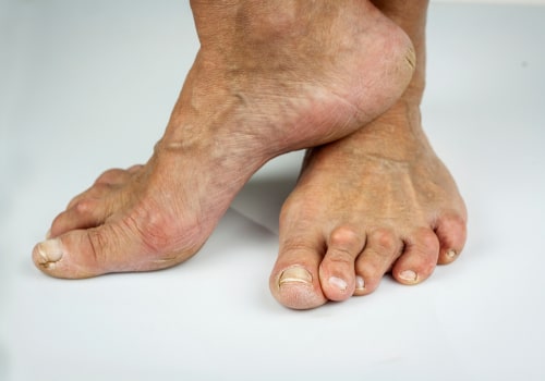 Expert Tips for Maintaining Healthy Feet as You Age