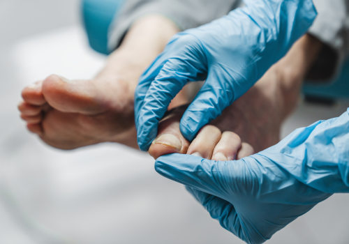 The Importance of Podiatry: Enhancing Lives and Promoting Health