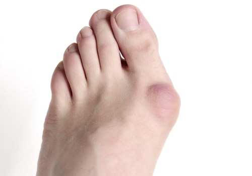 Expert Insights: Understanding and Treating Painful Foot Conditions